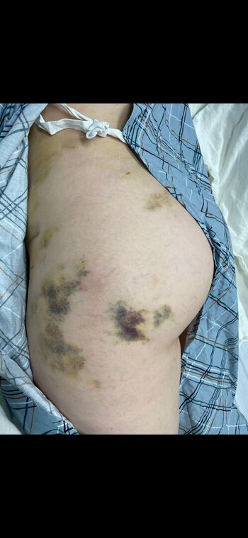 Blangelaaa/ leaked private content